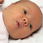 ویتامین D در دوران بارداری و بروز حساسیت غذایی نوزاد