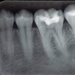 استفاده از cbct در دندان پزشکی